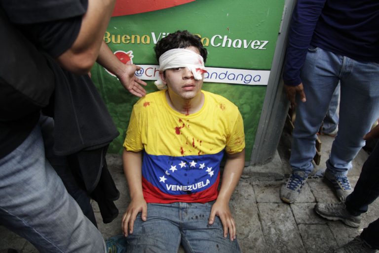 Foto: AP Photo / Ariana Cubillos