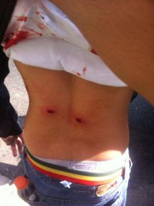 Venezuela Awareness