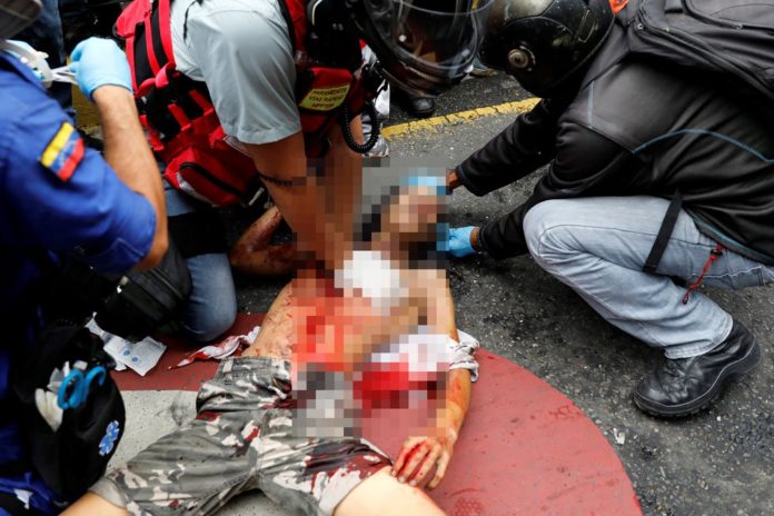 asesinadochacao980